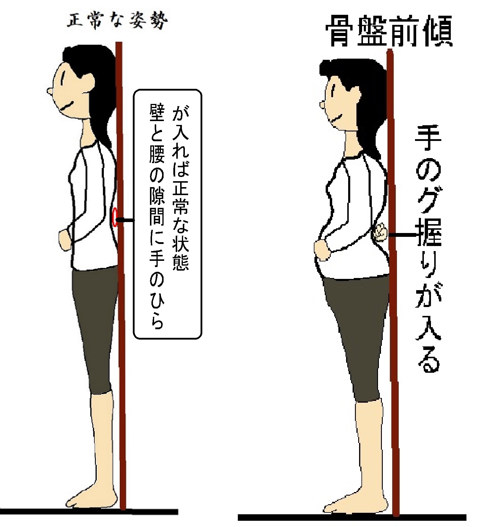 腰痛は骨盤の改善から