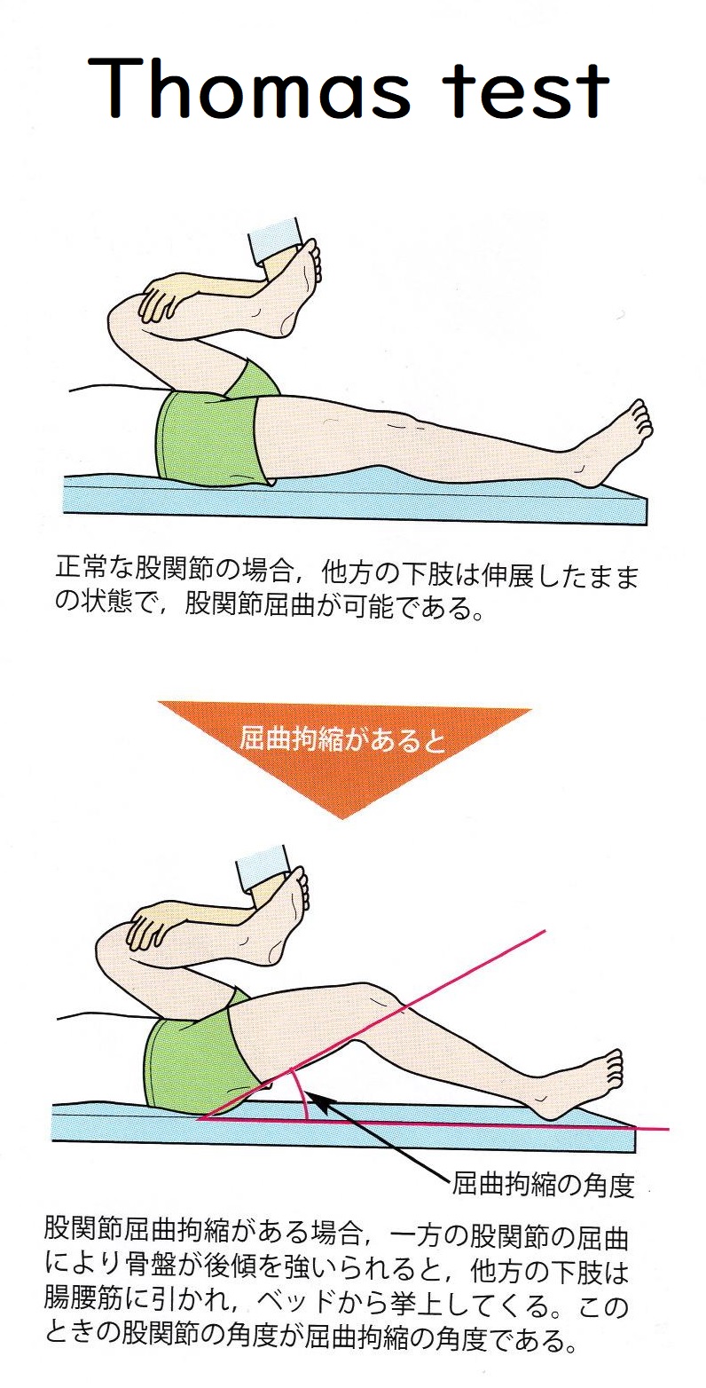 股関節に関わる筋肉のストレッチで腰痛の解消