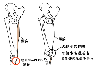 膝痛